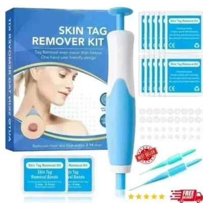 Natural Painless Auto SKIN TAG Removal Kit Skin Tag Micro Bands Remover Device