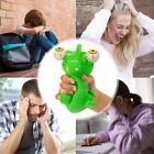 Squeeze Pop Eye Squeeze Antistress Toy Stress Reduction Ball Decompression Toy