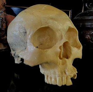 ANTIGUO YESO ANATÓMICO CRÁNEO HUMANO - ANATOMÍA ENSEÑANZA MÉDICA centavos 19-20 - Imagen 1 de 12