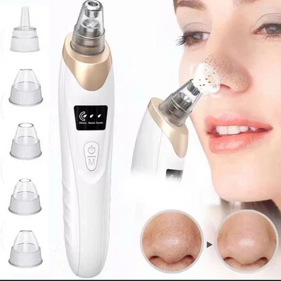Electric Pore Cleaner - Blackhead Remover with Vacuum Cleaner + Attachments - Image 1 of 4