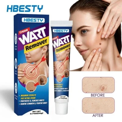 HBESTY Wart Removal Ointment | Easy-to-Use | Fast Results | Bestselling Care Sol