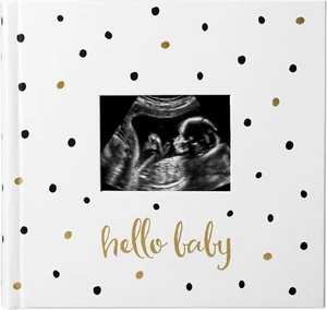 Pearhead Baby Photo Album Black and Gold Polka Dot- new but small dents on cover - Picture 1 of 1