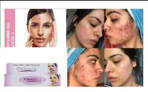 3 PACK Skin Lightening & Brightening Cream | Reduce Pimples & Dark Spots - 15gm - Picture 1 of 6