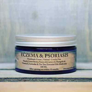 ECZEMA PSORIASIS ROSACEA Handmade Natural Skin Cream with Marigold and Neem oil  - Picture 1 of 6