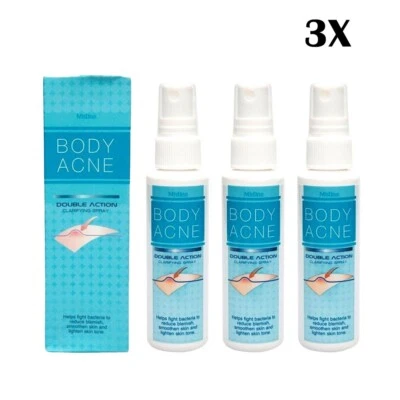 Mistine 身体痤疮治疗喷雾 双效抗背胸部瑕疵 50 毫升 3X — 第 1/4 张图片