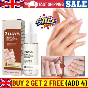 New 7 Days Nail Growth And Strengthening Serum Fast Dispatch ` - Picture 1 of 8