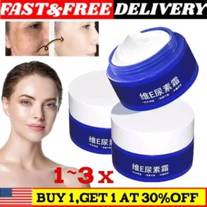 Crema de urea Spot Fading, 2025 nueva crema de urea con vitamina E, 2,47 fl. oz/70 g 1 ~ 3 piezas - Imagen 1 de 9