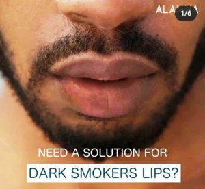 Dark Lips Bleaching Pink Lightening Cream Remove Smoke Lips Treatment Fresh F.S - Picture 1 of 5