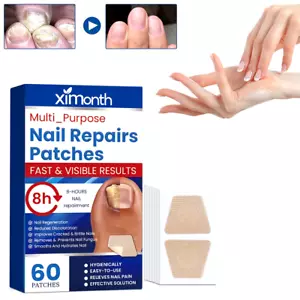 60Pcs Toenail Fungus Patch Waterproof Nail Repair Patches Nail Ingrown Correctio - Picture 1 of 6