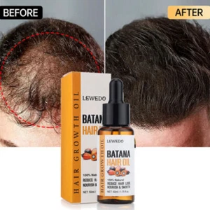 Batana Oil For Hair Growth, Batana Oil Serum Anti-Hair Loss, Repair Damaged Hair - Picture 1 of 14