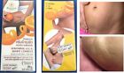 THe Best Stretch Mark Moisturizing Body Cream Stretch Mark Prevention Cream  