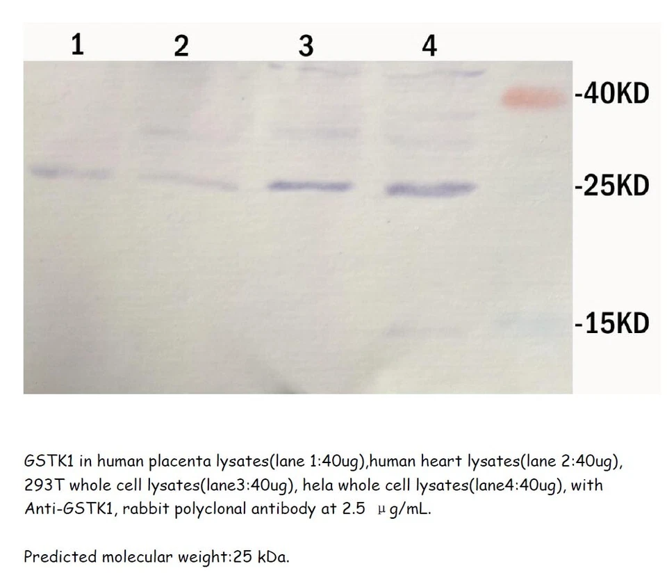 兔子抗人类 GSTK1 多克隆抗体,100uL,www.sunnybiotechnology.com  — 第 1/1 张图片