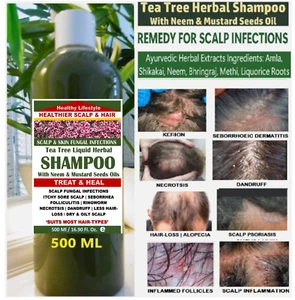 Sore Scalp Fungus Infections Sooth Treat & Heal Herbal Tea Tree Shampoo 500 ML - Picture 1 of 6