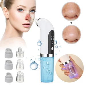 Small Bubble Electric Blackhead Remover Cleaner Face Diamond Pore Vacuum Suction - Picture 1 of 11