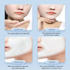 Silicone Face Mask Reusable Anti Wrinkle V Shape Face Firming Gel Sheet EarFixe