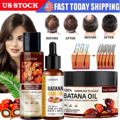 1-2x ACEITE DE BATANA NATURAL Suero para el crecimiento del cabello Champú Acondicionador Rápido Regeneración del cabello Foto 1 de 4