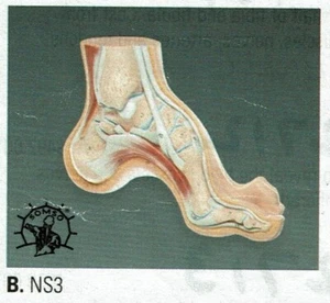 Modelo anatómico pie arqueado SOMSO NS-3 calidad profesional ¡Haznos una oferta! - Imagen 1 de 1