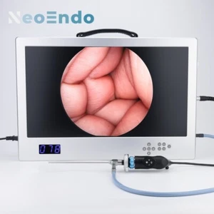 Full HD Endoscope Camera With 24 Inch Monitor 80W LED Light Source With Recorder - Picture 1 of 20