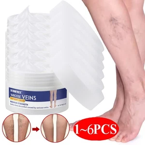 1-6PCS Varicose Veins Cream, Spider Veins Repair Cream, Varicose Treatment Vein - Picture 1 of 27