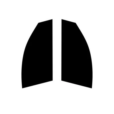 Tinte de ventana de coche precortado para Chrysler 200 4 puertas Berlina 2011-14 ventanas delanteras Foto 1 de 4