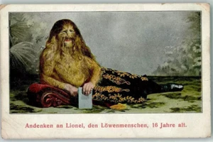 Vintage RPPC Photo of Lion Face Man! Carnival Circus Freak Postcard 1910s - Picture 1 of 1