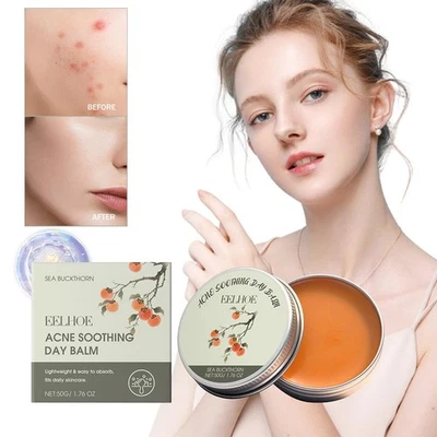 Oil-controlling cream High Performance Acne Skin Care/ Z0B7 - Image 1 of 4