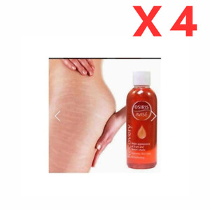 X4 Osiris Avis Recovery Oil: Effective Solution for Stretch Marks and Blemishes