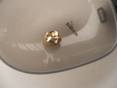 Zahngold Bruchgold Altgold 2,9 Gramm - Bild 1 von 4