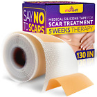 Silicone Scar Tape for Surgical Scars, Acne Scars, C-Section, Tummy Tuck - Conve