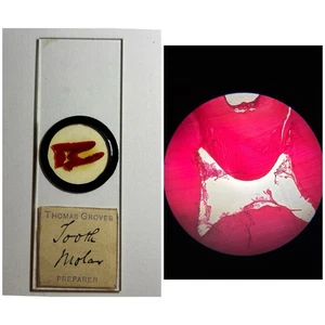Antique Microscope Slide. Showing Human Molar. By Thomas Groves. - Picture 1 of 3