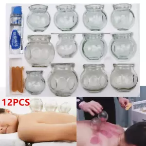 Feuerschröpfgläser Schröpfgläser Glas Schröpfglas Massage Banki Feuerschröpfen - Bild 1 von 11