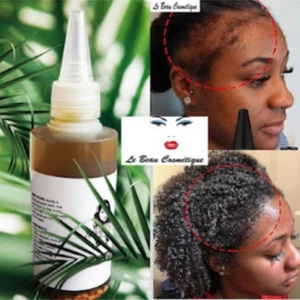Fenugreek Cloves Herbal Hair Growth Oil - Mega hair Growth 100ml - Picture 1 of 6