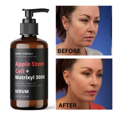 Hyaluronic Acid , Apple Stem-Cell + Matrixyl 3000 Peptide AntiAging Serum - 4 oz - Image 1 of 3