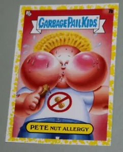 GARBAGE PAIL KIDS 2021 FOODFIGHT "YELLOW" card #7a Pete Nut Allergy - Picture 1 of 3