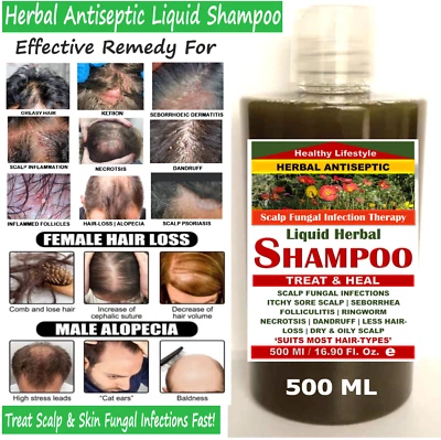 HEALTHY LIFESTYLE HERBAL ANTISEPTIC SHAMPOO Fungal Scalp Skin Infection Fast Potent Remedy ANTISEPTIC HERBAL SHAMPOO 500 ML