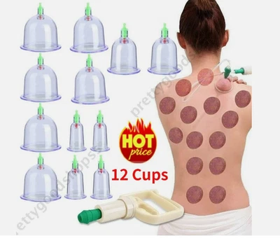Conjunto de 12 xícaras de ventosa médica chinesa massagem corporal terapia sucção saudável - Imagem 1 de 4