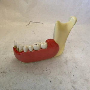 Expositor dental vintage modelo anatómico mandíbula inferior diente retracción encías - Imagen 1 de 13