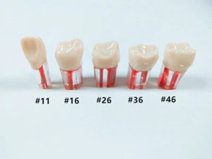 Dental Module Model Pulp Practise Root Canal File Dentist Study Student Training - Picture 1 of 8