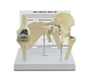 Implant Mini-Implant Joint Anatomical Model Set of 3 GPI LFA #1910 Make An Offer - Picture 1 of 3