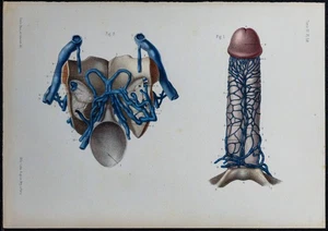 1866 - Veines de la verge (Pénis) - Anatomie & Angiologie - Gravure ancienne - Foto 1 di 5