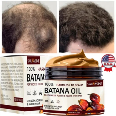 Acondicionador de aceite de batana natural para el crecimiento del cabello tratamiento de pérdida de cabello para hombres y mujeres Foto 1 de 4
