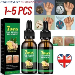 1 ~ 5 Stück Ingwer Nagelbehandlung Nagelpflege, Nagelwachstumsöl zur Nagelhautpflege ~ - Bild 1 von 14