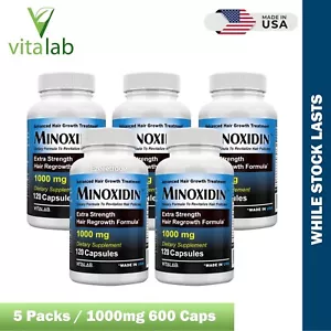 MINOXIDINA 1000mg Crecimiento del Cabello 120 Comprimidos Extra Fuerza Hombres Mujeres Recrecimiento EE. UU. - Imagen 1 de 21