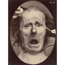 Tournachon Electro Physiology Facial Expressions 1862 Wall Art Canvas Print