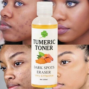 Tumeric Dark Spots Whitening Brightening Moisturizing Blemishes Toner 100ml - Picture 1 of 5