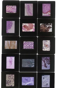 HUGE LOT OF 2,500 VINTAGE MEDICAL PATHOLOGY 35MM MICROSCOPIC SLIDES Blood Germs - Picture 1 of 6