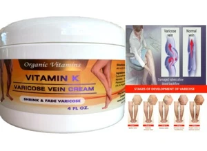 Vitamin K Cream For Spider Varicose Veins Scars Rosacea Capillaries serum CREAM - Picture 1 of 7