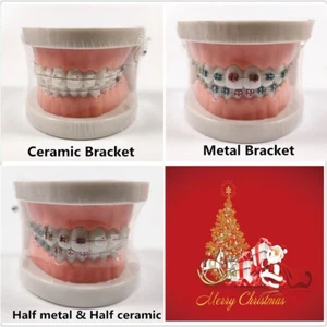 Dental Demonstration Study Model Orthodontic Ceramic Metal Bracket Arch Wire - Picture 1 of 10