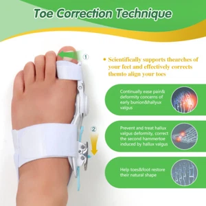 Corrector de juanete ortopédico soporte enderezador de dedos Hallux Valgus para hombre mujer - Imagen 1 de 13