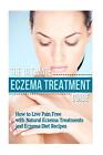 The Ultimate Eczema Treatment Guide: How to Live Pain Free with Natural Eczem<|